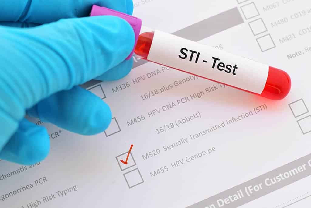 Goromonzi district tops in STI infections
